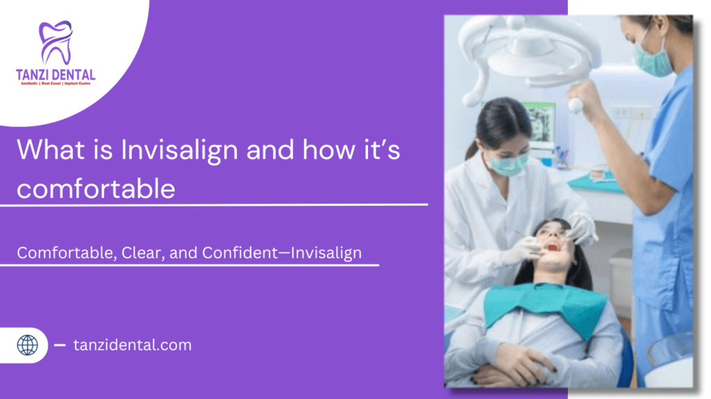 Invisalign Cost in Chennai