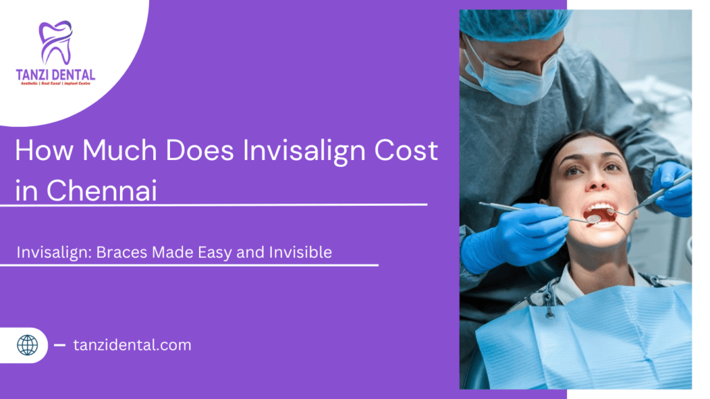 Invisalign Cost in Chennai
