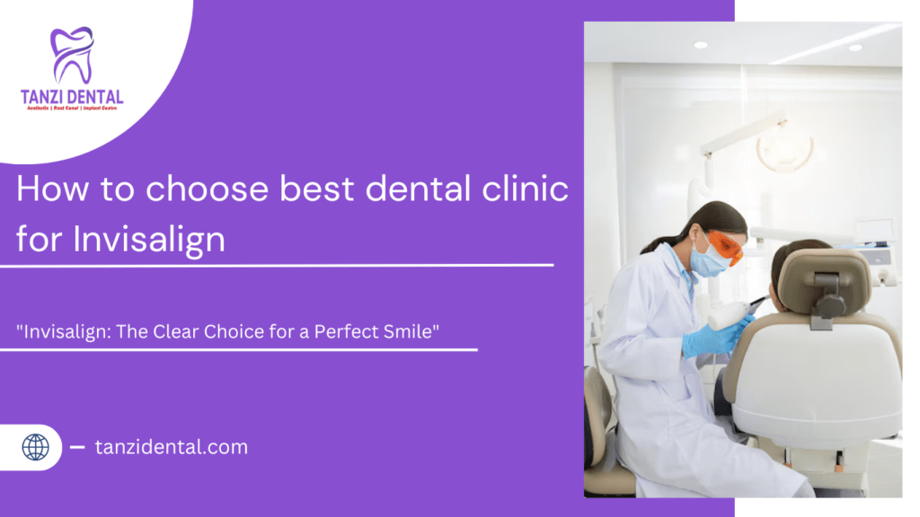 Invisalign Cost in Chennai