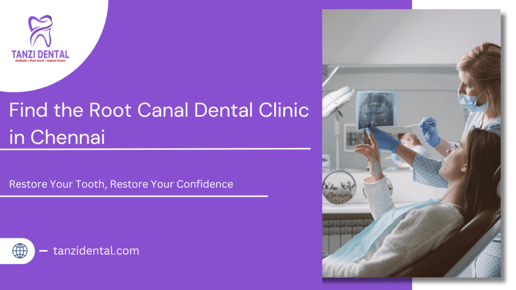 best root canal dental clinic in Chennai