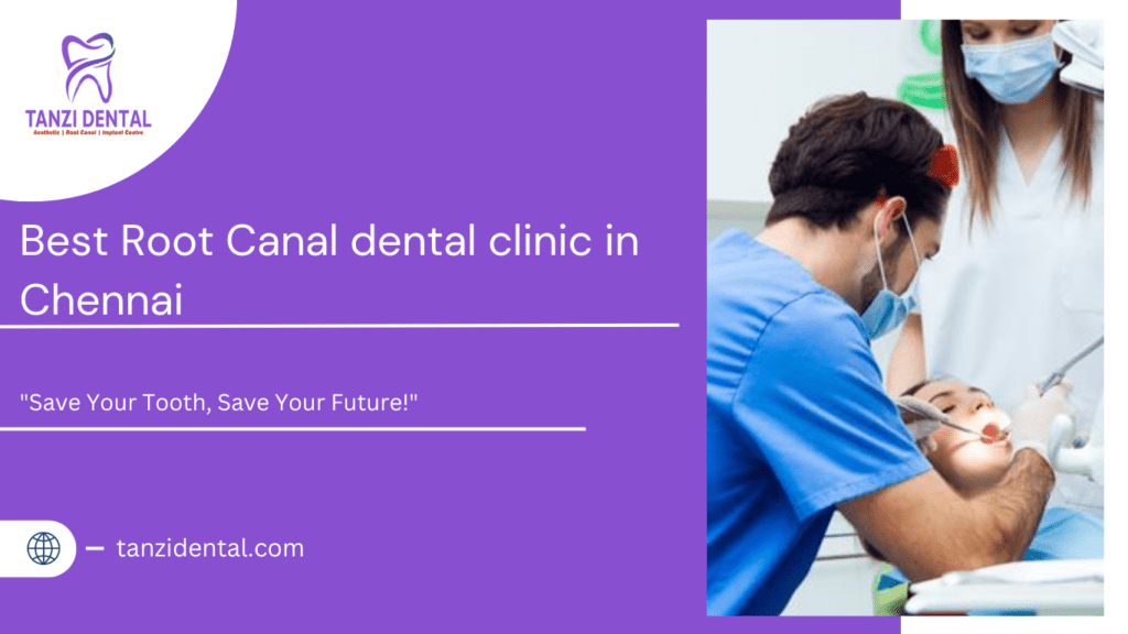 Best root canal dental clinic in Chennai